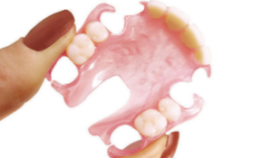Съемные гибкие зубные протезы