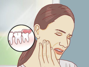 Последствия ретенции зубов