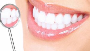 Что важно знать после отбеливания зубов?