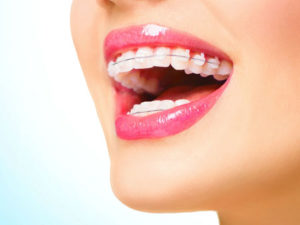 Уход за зубами после установки пломбы