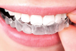 Правильный ортодонт в стоматологии