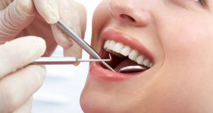 Удаление зубов мудрости в стоматологии