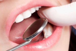 Молочные зубы можно не лечить?
